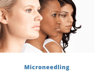 Micro