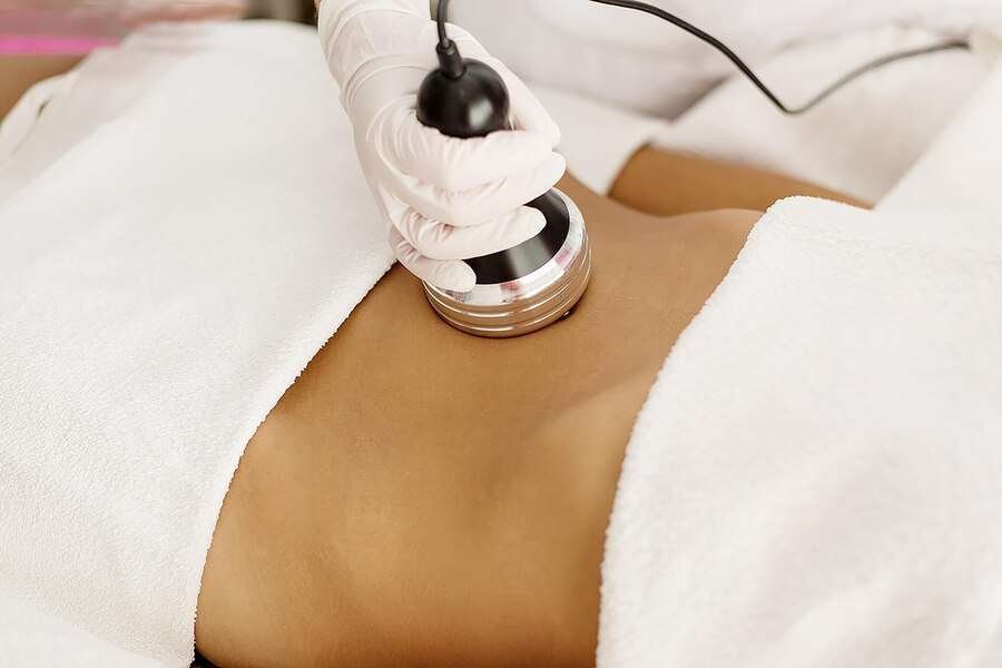 CoolSculpting