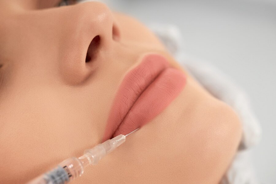 Juvederm (4)